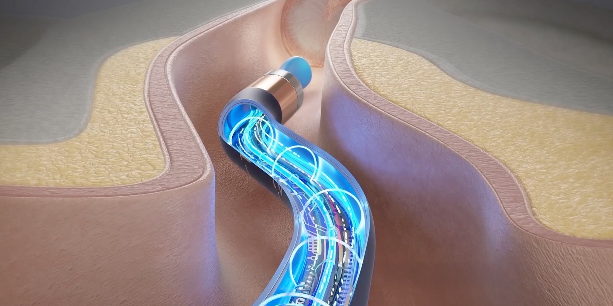 width=100% Urządzenie do czyszczenia uszu Bebird EarSight Plus I35R - niebieski